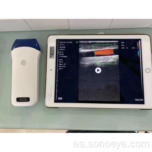 Dispositivos de ultrasonido de mano inalámbrico